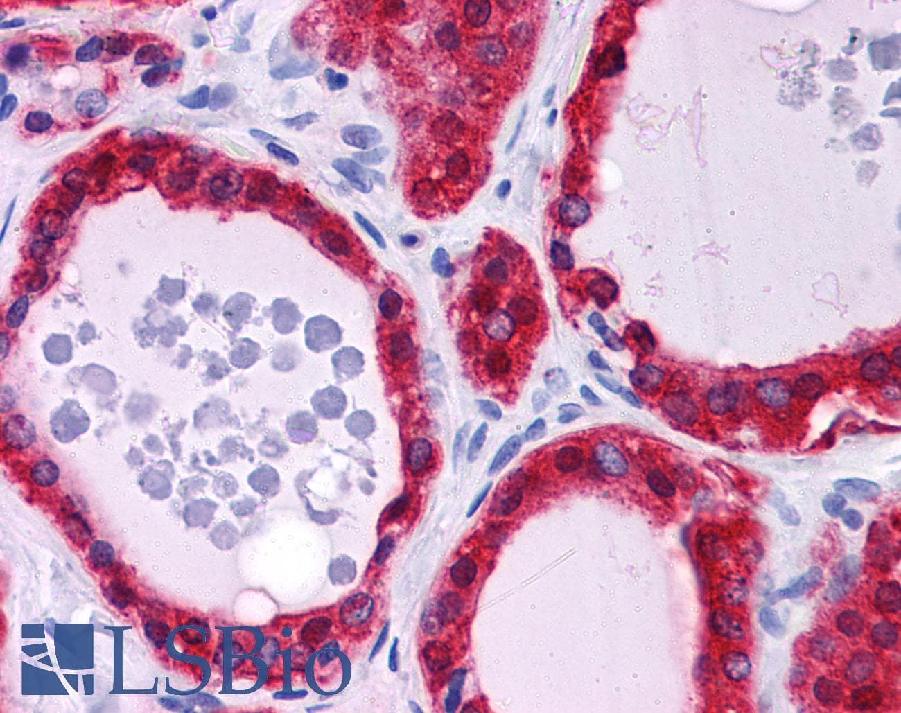 IHC-plus™ TSPAN9 Antibody