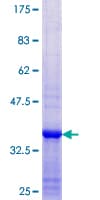 Human RIOK2 Protein (Recombinant GST, N-terminus)