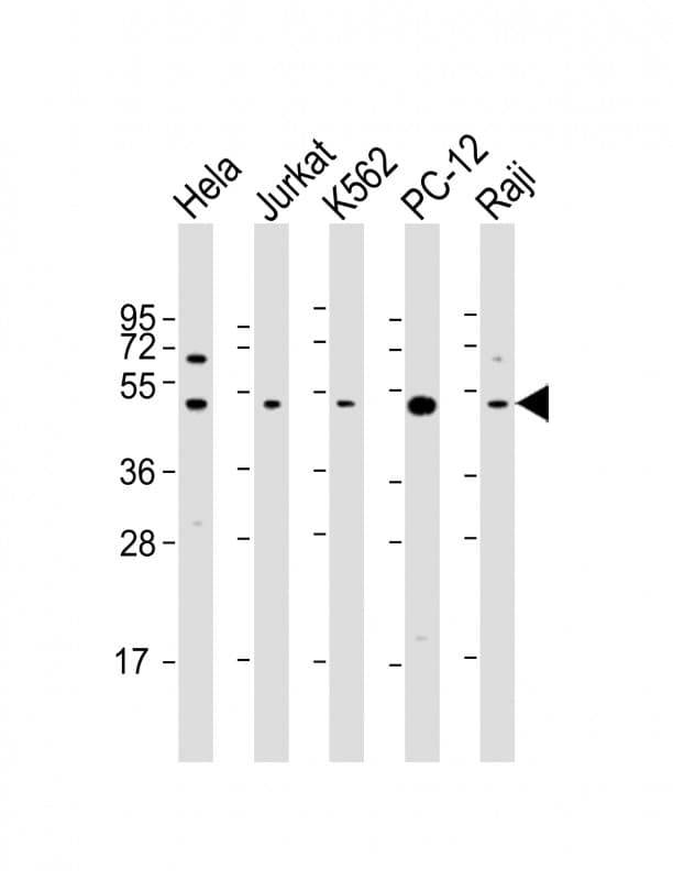 RPL4 / Ribosomal Protein L4 Antibody (C-Terminus)