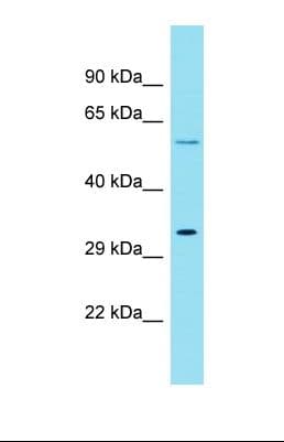 Polyclonal Rabbit anti-Human KRT79 / Keratin 79 Antibody (aa317-366, WB)