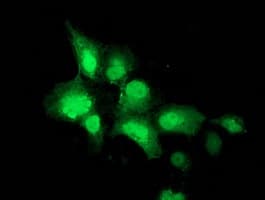 NEU2 / Sialidase 2 Antibody (clone OTI4F4)