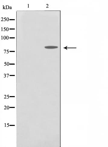 MMP15 Antibody
