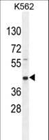 RPH3AL Antibody (aa208-237)