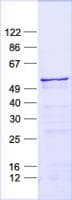 Human ZIC3 Protein (Recombinant His, N-Terminal)