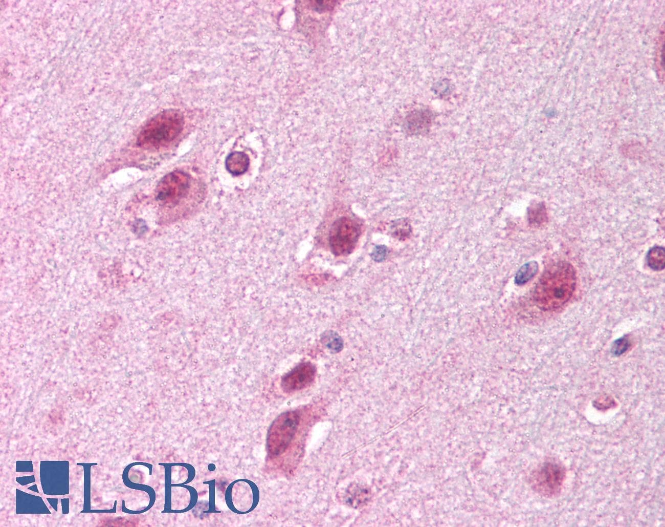 HUWE1 / ARFBP1 Antibody