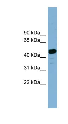 TASP / LANCL2 Antibody (aa179-228)