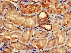 IREB2 / IRP2 Antibody