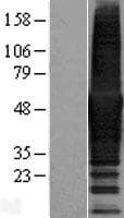 CORO1B Protein (Over-Expression Lysate Myc-DDK (Flag))