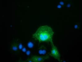 FAM84B Antibody (clone OTI10A2, Carrier-free)