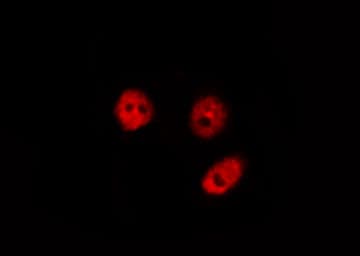 NFKB1 / NF-Kappa-B Antibody (phospho-Ser907)