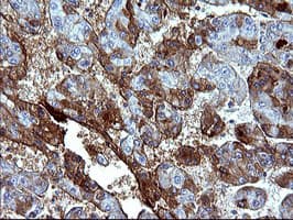 SERPINB3 Antibody (clone OTI1G9)