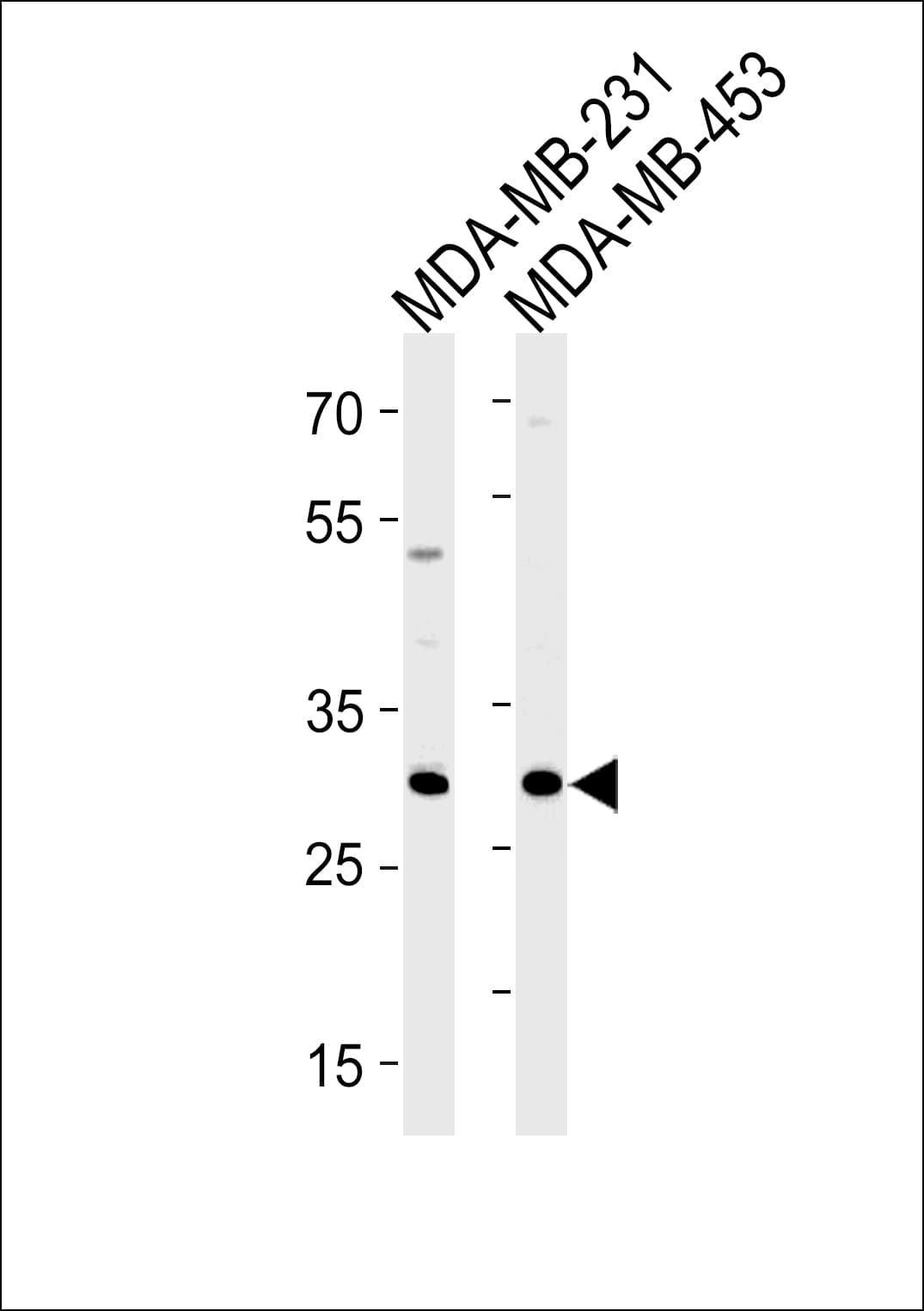 Polyclonal Rabbit anti-Human ASB11 Antibody (aa26-54, WB)
