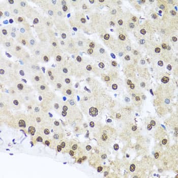 FUBP1 Antibody
