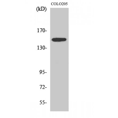 Polyclonal Rabbit anti-Human SLK Antibody (1120-1200 aa, C-terminal, IHC, IF, WB)