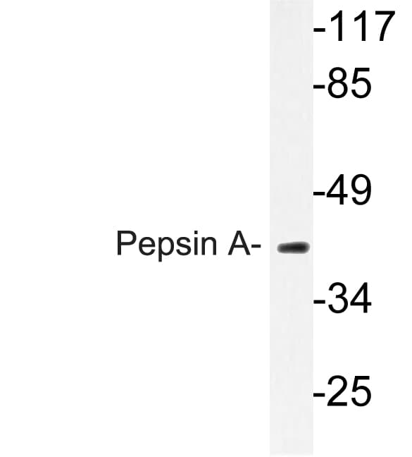 PGA5 / Pepsin A Antibody (Met307)