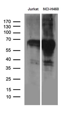 GTF2A1L / ALF Antibody (aa183-478, clone OTI1D3)