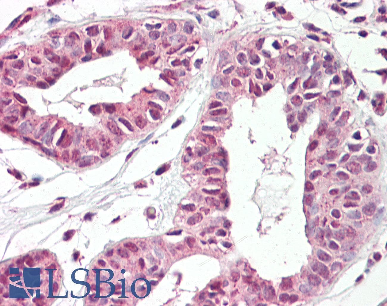 IHC-plus™ Polyclonal Goat anti-Human TREX2 Antibody (aa36-48, IHC)