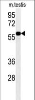 DKC1 / Dyskerin Antibody (aa185-213)