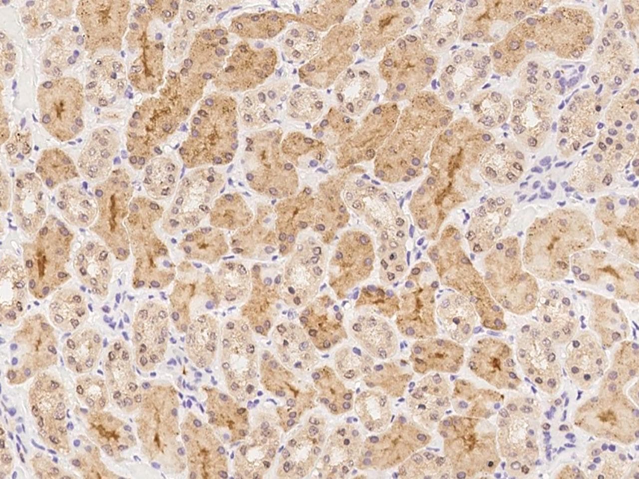 PTGR2 / PGR2 Antibody