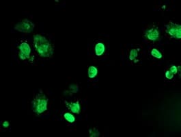 Monoclonal Mouse anti-Human FOXI1 Antibody (clone OTI2G6, aa111-350, IHC, IF, WB)