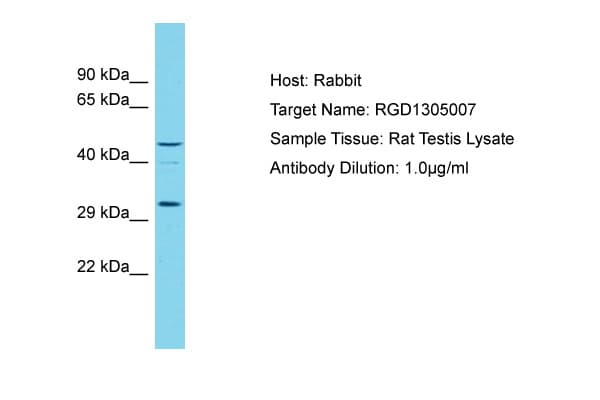 OGFOD3 Antibody (aa95-144)