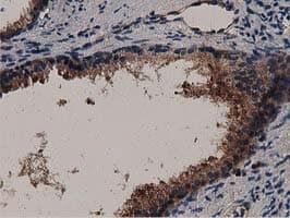 Monoclonal Mouse anti-Human MYD88 Antibody (clone OTI2B2, IHC, IF, WB)