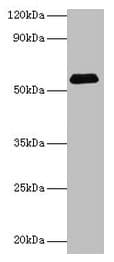 Polyclonal Rabbit anti-Human SUOX / Sulfite Oxidase Antibody (IHC, WB)