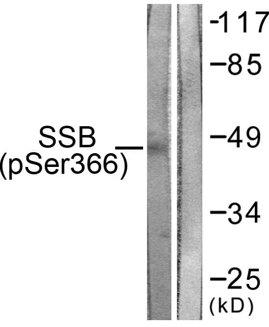 SSB / La Antibody (phospho-Ser366)