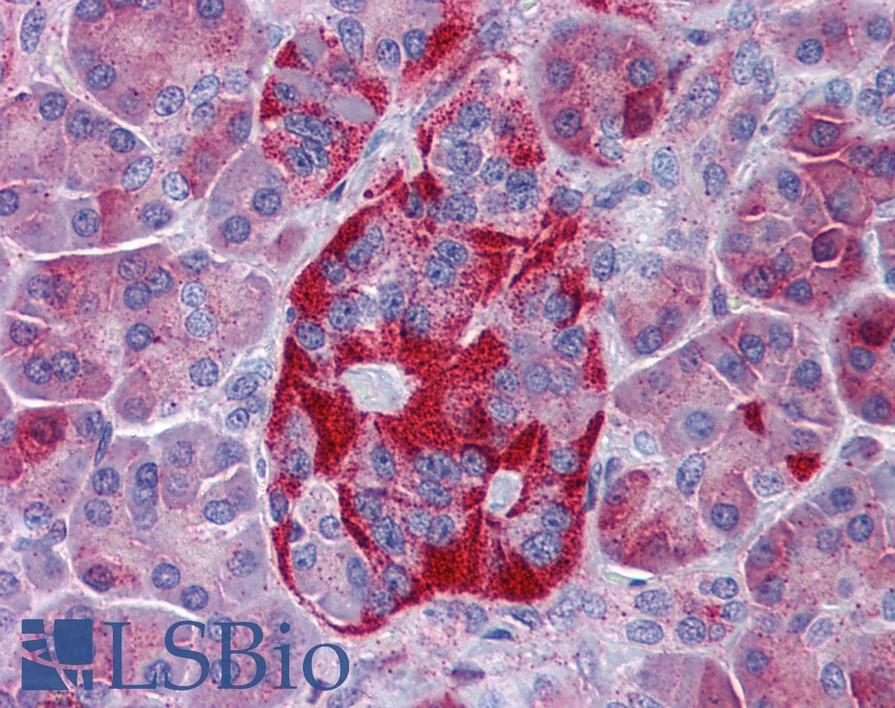 Polyclonal Rabbit anti-Human EPHX4 / Epoxide Hydrolase 4 Antibody (aa71-120, IHC, WB)