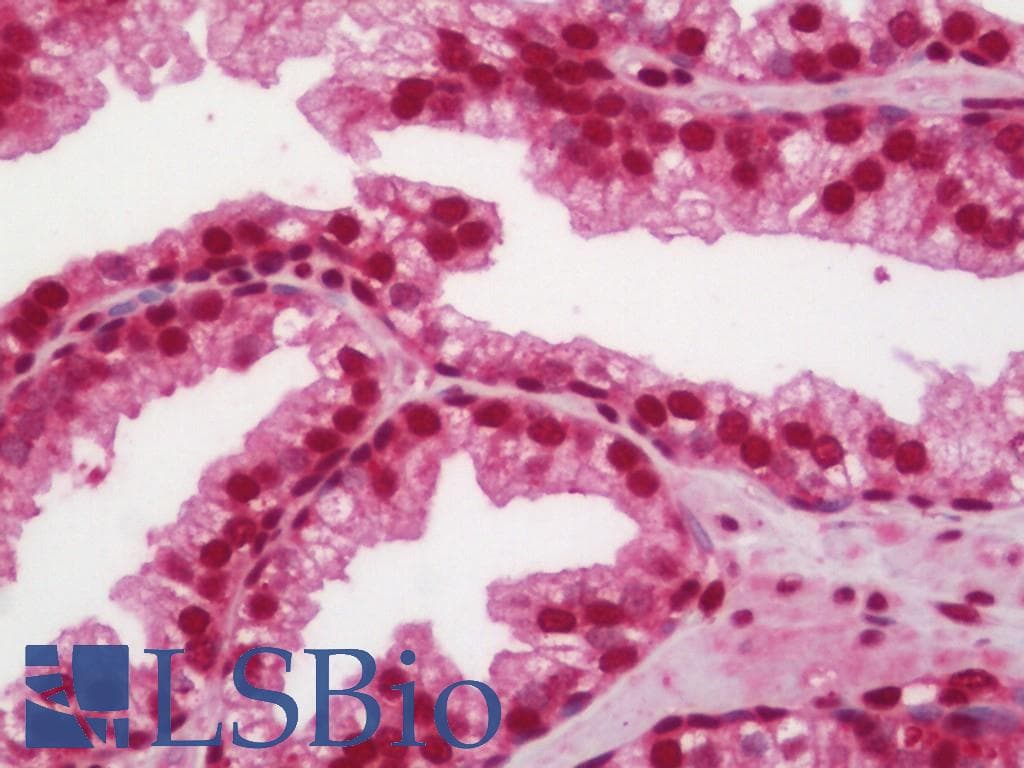 PathPlus™ AKT1 Antibody (aa416-465)
