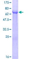 Human Dipeptidase 2 / DPEP2 Protein (Recombinant GST)