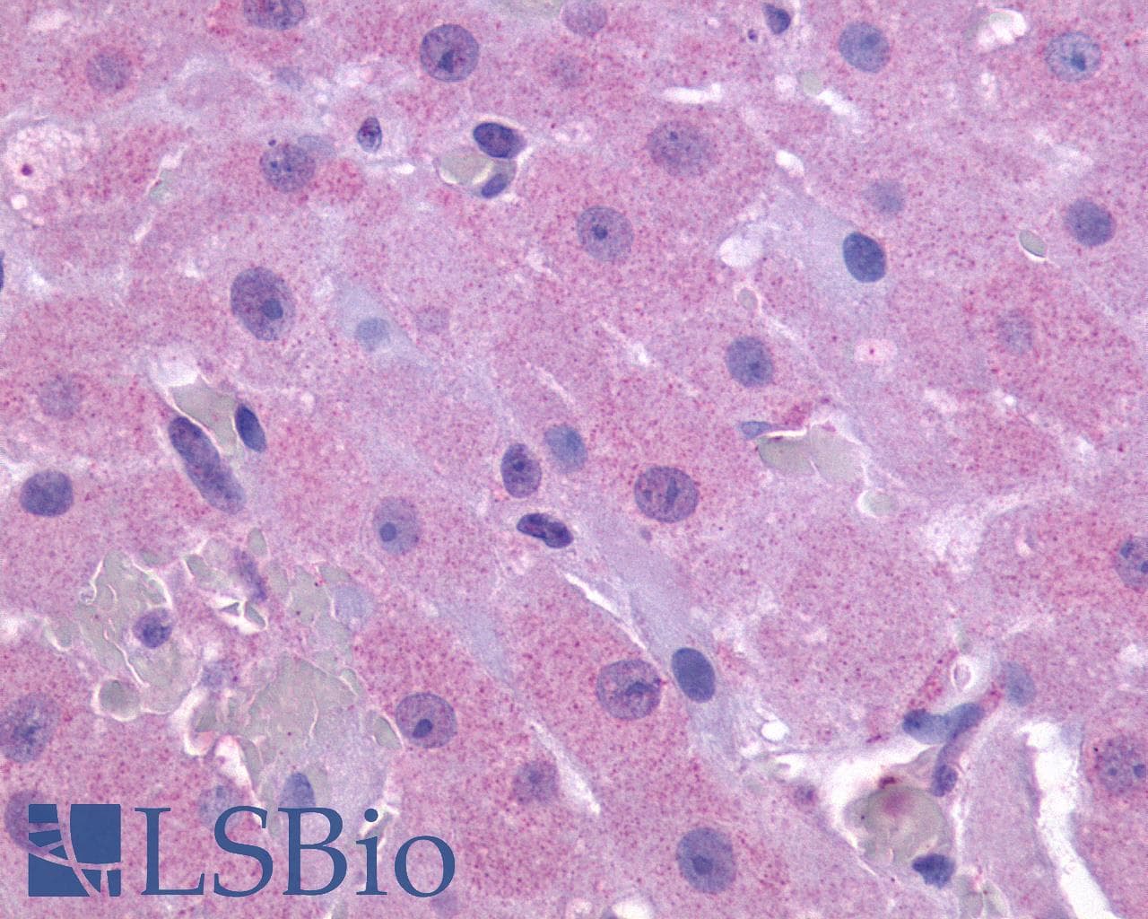 PathPlus™ FP / PTGFR Antibody (Extracellular Domain)