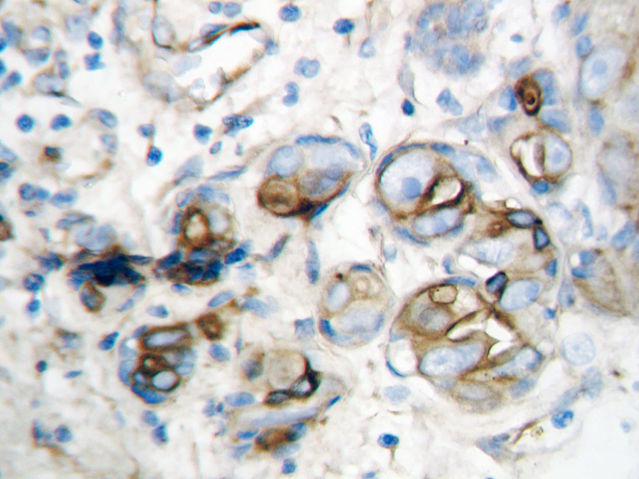 Polyclonal Rabbit anti-Human CXCL10 / IP-10 Antibody (aa79-98, IHC, WB)