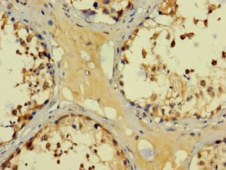 Polyclonal Rabbit anti-Human BAGE3 Antibody