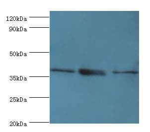 TMOD3 / Tropomodulin 3 Antibody (aa1-352)