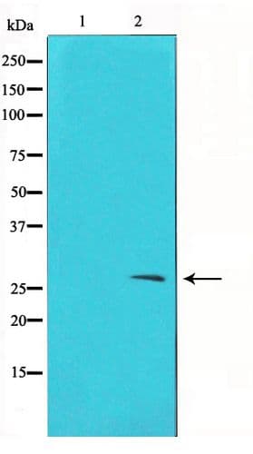 Polyclonal Rabbit anti-Human TIMP2 Antibody (IF, WB)