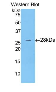 CTNNB1 / Beta Catenin Antibody (aa439-675)