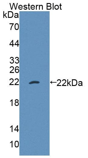 DKC1 / Dyskerin Antibody (aa298-465)