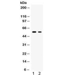 Polyclonal Rabbit anti-Human SLC2A5 / GLUT5 Antibody (IHC, WB)