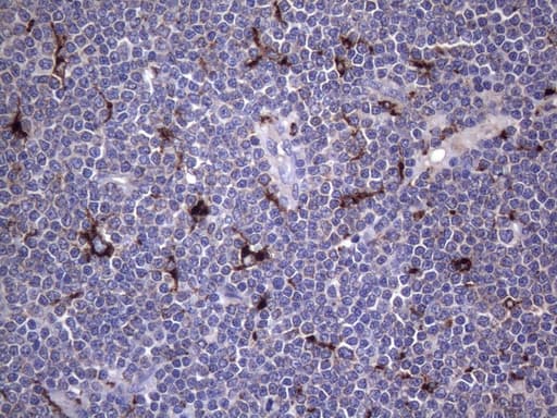 CD68 Antibody (clone KP1)