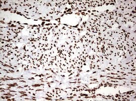 Monoclonal Mouse anti-Human HNRPM / HNRNPM Antibody (clone OTI3F3, aa1-261, IHC, WB)