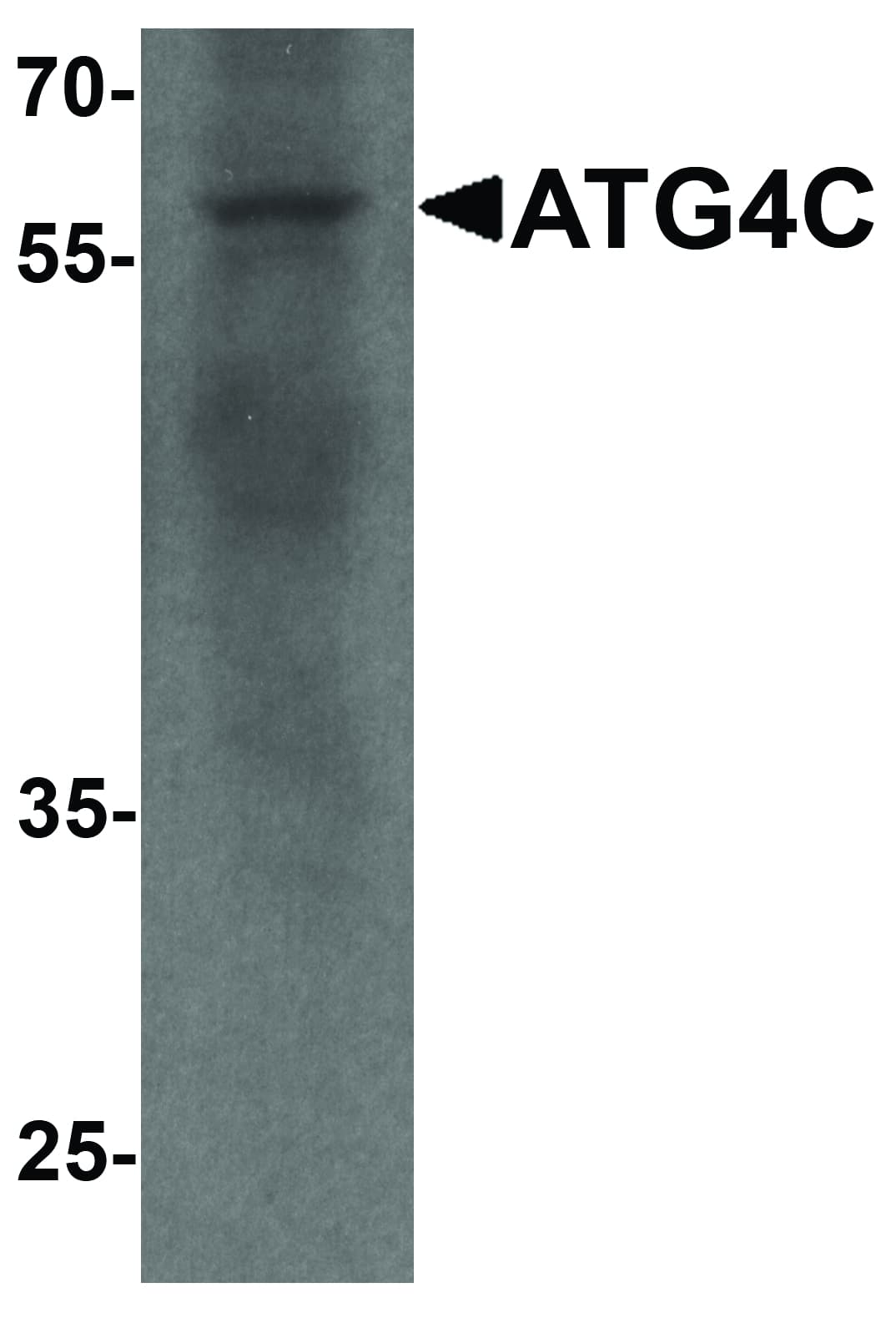 IHC-plus™ AUTL1 / ATG4C Antibody