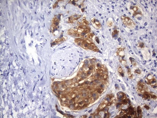 Monoclonal Mouse anti-Human AMACR / P504S Antibody (clone UMAB215, IHC)