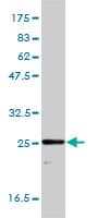 TPI1 / TPI Antibody (clone 1D10-2E2)