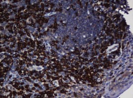 UBE2J1 Antibody (clone OTI3D5, Carrier-free)