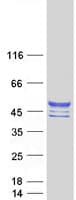Human CHST10 Protein (Recombinant Myc-DDK (Flag))