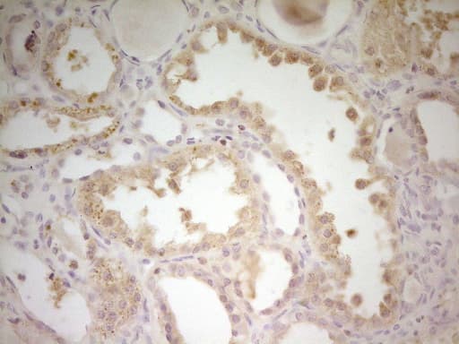 S100A1 / S100-A1 Antibody (clone OTI2A4)