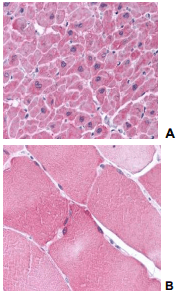 Polyclonal Rabbit anti-Human ARC / Arg3.1 Antibody (IHC, WB)
