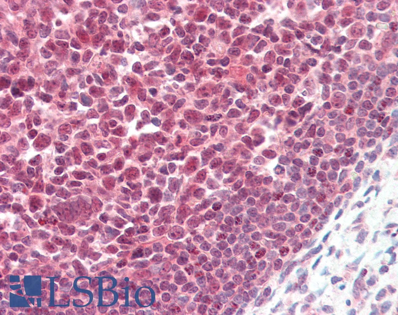 IHC-plus™ PARP1 Antibody (aa396-412)