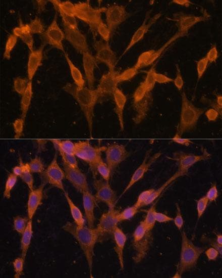 UBQLNL Antibody
